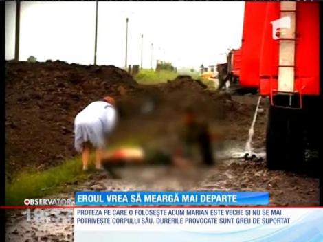 Eroul de la Mihăileşti care şi-a pierdut un picior are nevoie de ajutor