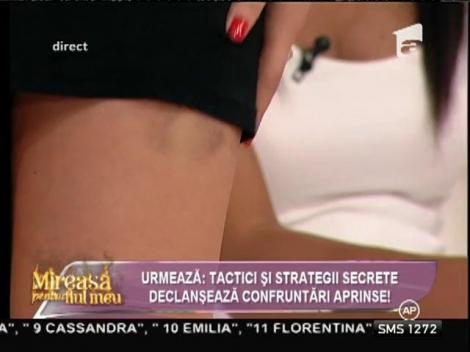 Cassandra, învinețită de Robert! Bruneta are semne pe ambele picioare!