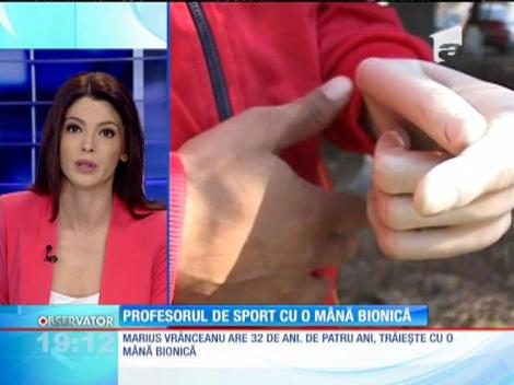 Un profesor de sport din Bacău trăieşte de patru ani cu o mână bionică