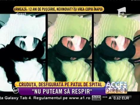 Daniela Crudu, desfigurată pe patul de spital