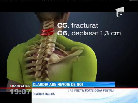 pentru a scăpa de paralizie, Claudia are nevoie de sânge grupa A2 pozitiv!!