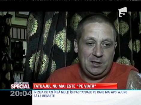 SPECIAL! Soluția tatuajelor ratate