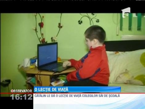 La doar 13 ani suferă de boala oaselor de sticlă