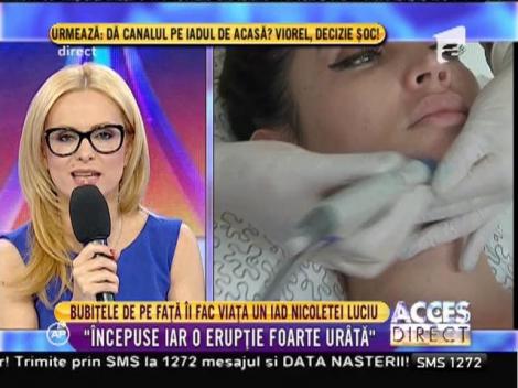 Problemele cu tenul i-au dat mari bătăi de cap Nicoletei Luciu