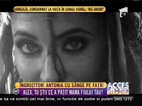 Antonia, filmată cu sângele curgându-i pe chip