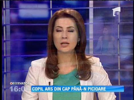 Un copil din Botoşani a ajuns la spital cu arsuri pe 70% din suprafaţa corpului