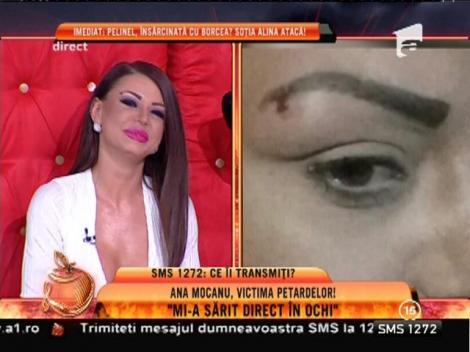 Ana Mocanu, victima petardelor: ”Mi-a sărit direct în ochi”