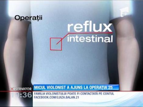 Micul violonist a ajuns la operația 25