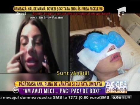 Tineţi-vă bine! Păcătoasa Ana, plină de vânătăi și cu fața umflată