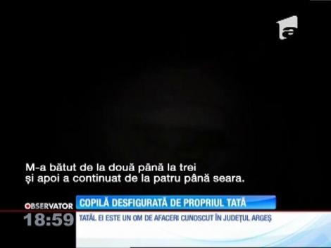 Fiica unui om de afaceri din Argeş îşi acuză propriul tată că a spulberat-o în bătaie