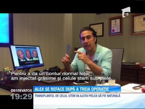 Alex, băiatul mutilat într-o explozie, se reface după a treia operaţie de reconstrucţie