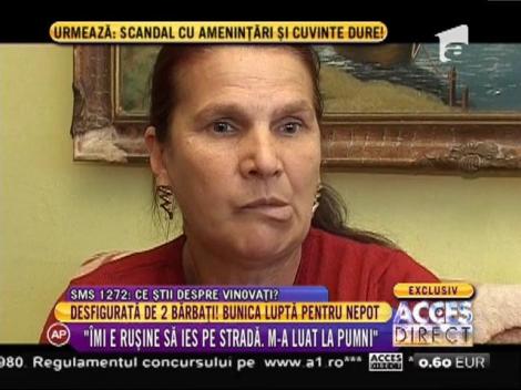 Desfigurată de doi bărbați, bunica luptă pentru nepot!