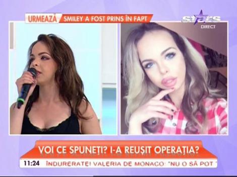 Imagini în premieră! Barbie de România are o nouă înfățișare. Fosta concurentă X Factor și-a prezentat noul năsuc!