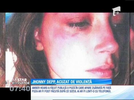 Veste ȘOC la Hollywood! Soția lui Johnny Depp s-a afișat cu lovituri pe față și susține că ar fi fost bătută de actor
