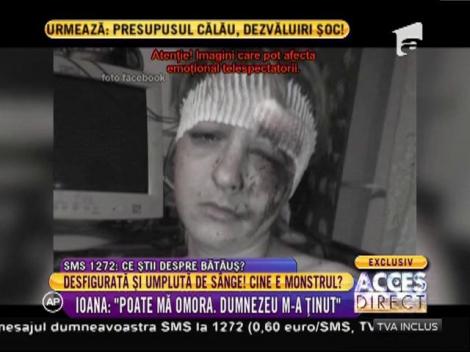 Șocant! Desfigurată și umplută de sânge de un vecin: ”Îmi este frică să ies din casă”