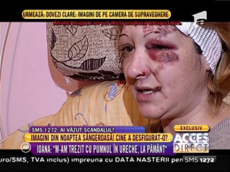 Plină de vânătăi! Ioana: ”M-am trezit cu pumnul în ureche”