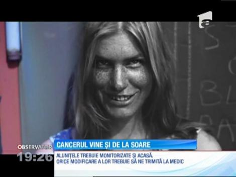 Expunerea neprotejată la soare poate duce la cancer de piele