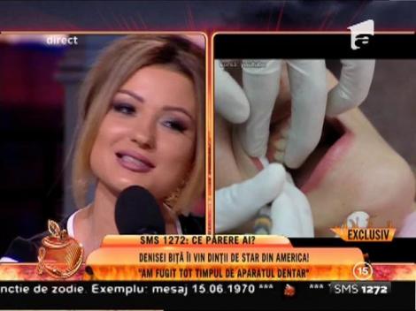 Denisei Biţă îi vin dinţii de star din SUA: "Am fugit tot timpul de aparatul dentar!"