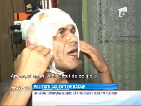 Un bărbat din Orşova susţine că a fost bătut de câţiva poliţişti