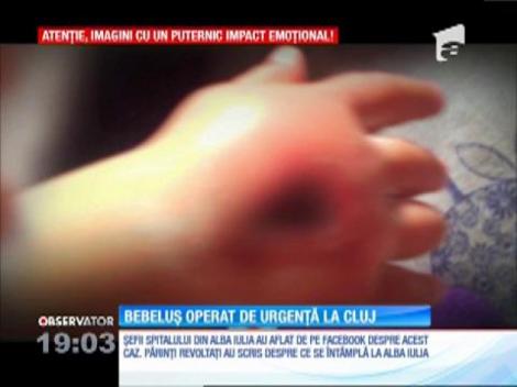O branulă montată greşit la mâna unui bebeluş i-a distrus tesuturile şi i-a infectat mâna dreaptă