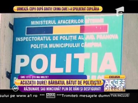 Un tânăr de 28 de ani acuză doi poliţişti că l-ar fi bătut crunt!