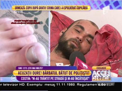 Costin Sofianu, acuzaţii grave la adresa poliţiştilor: "După ce mi-au rupt oasele au vrut să o dea la pace!"