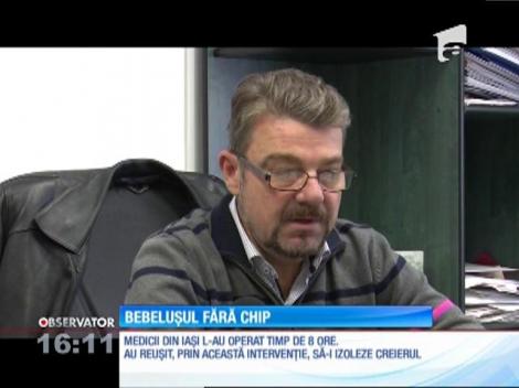 Un bebeluş născut cu o malformaţie extrem de rară la faţă, operat cu succes la Iaşi