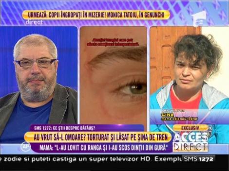 Mama copilului torturat și lăsat pe șina de tren: ”Copilul meu a stat 18 zile la terapie intensivă”