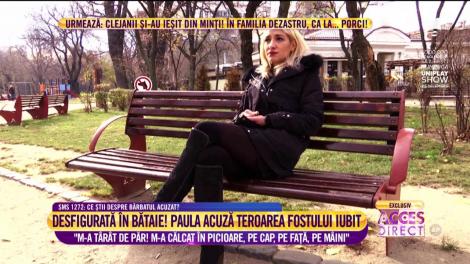 Paula Mihale, o tânără desfigurată în bătaie, acuză teroarea fostului iubit