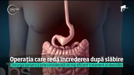 Chirurgia bariatrică este considerată cel mai eficient tratament al obezității