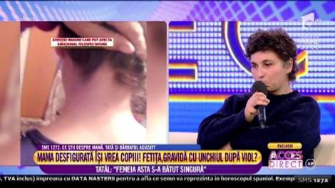 Bărbatul acuzat că și-a desfigurat iubita: ”Nu am bătut-o eu. S-a bătut singură!”