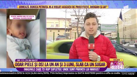 Imagini șocante! La un an și 3 luni cântărește doar 3 kilograme, ca un nou-născut!