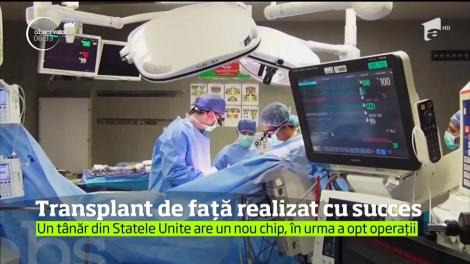 Transplant de faţă realizat cu succes în SUA