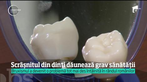 Avertisment din partea medicilor. Scrâşnitul din dinţi dăunează grav sănătăţii !