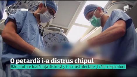 Un bărbat va rămâne mutilat pe viaţă după ce a încercat să se sinucidă cu o petardă