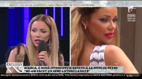 Bianca Drăguşanu, o nouă intervenţie estetică. „Scopul era să se și vadă!”
