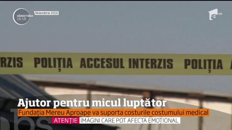 Imagini șocante! Fundaţiei Mereu Aproape, ajutor pentru copilul incendiat de propriul tată