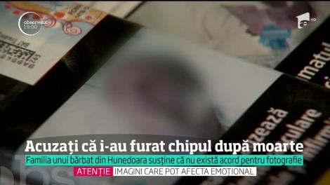 ȘOCANT. Povestea ÎNFIORĂTOARE a bărbatului intubat de pe pachetele de țigări! Copiii românului sunt revoltați!