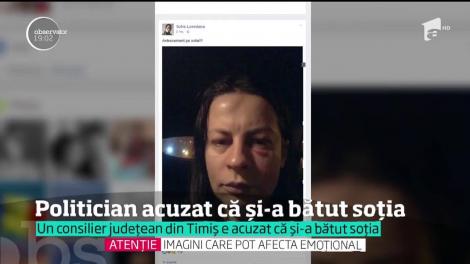 Un consilier judeţean din Timiş, acuzat că şi-a bătut crunt soţia