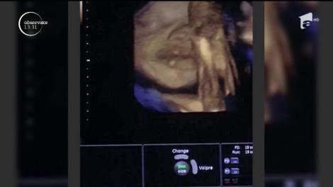 Mădălina Ghenea şi iubitul ei, Matei Stratan, au devenit părinţi