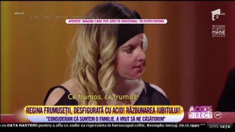 Imagini &Icirc;NGROZITOARE. O fostă c&acirc;știgătoare a concursului de Miss a fost desfigurată de fostul iubit! Bărbatul i-a turnat acid sulfuric pe chip