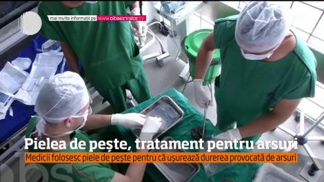 Pielea de pește, tratament pentru arsuri! O metodă testată pe pacienți de medicii din Brazilia.