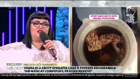 Ozana Barabancea şi-a făcut operaţia care îi topeşte kilogramele! "Mi-am tăiat o parte din stomac"