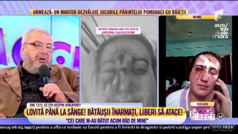 Și-a apărat pruncii cu prețul vieții! Femeia care a fost desfiguraă de bătăile primite spune adevărul!