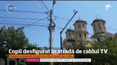 Incident şocant în Iaşi. Un copil de 12 ani a ajuns desfigurat la spital după ce a fost lovit de un cablu TV, rupt de un autobuz în mers