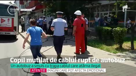 Un copil a fost desfigurat, într-o intersecţie din Iaşi, de un cablu de telefonie smuls de un autobuz