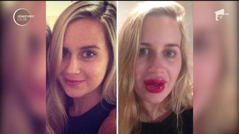 Tot mai mulţi tineri fac abuz de proceduri şi operaţii estetice