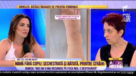 Victimă a violențelor soțului, Magdalena a fost sechestrată și bătută printre străini. Mama tinerei de 26 de ani e disperată: ”Nici nu o mai recunosc pe fiica mea. Este desfigurată!”