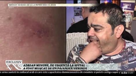 Panică în familia cântărețului! Adrian Minune a ajuns de urgență la spital, după ce a fost mușcat de un păianjen veninos