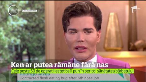 Rodrigo Alves, supranumit păpuşă umană Ken, ar putea rămâne fără nas